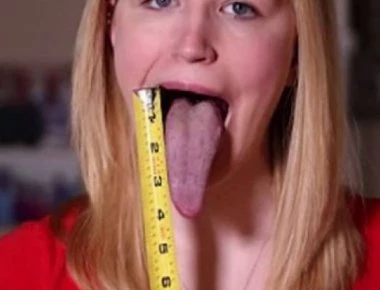 Αυτοί οι άνθρωποι «κουβαλούν» ασυνήθιστα μεγάλα μέλη σώματος και σοκάρουν (βίντεο)